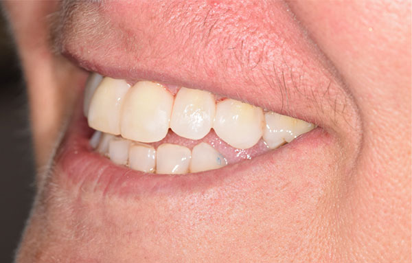 Dentisterie esthétique